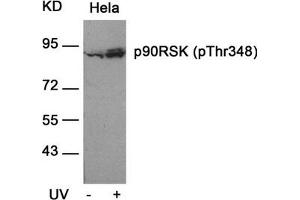 Western blot analysis of extracts from Hela cells untreated or treated with UV using p90RSK(Phospho-Thr348) Antibody. (RPS6KA1 antibody  (pThr348))