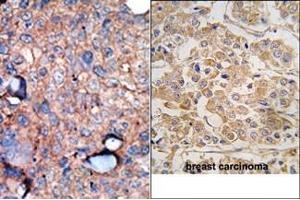 Image no. 2 for anti-Inhibitor of kappa Light Polypeptide Gene Enhancer in B-Cells, Kinase epsilon (IKBKE) (C-Term) antibody (ABIN360635) (IKKi/IKKe antibody  (C-Term))