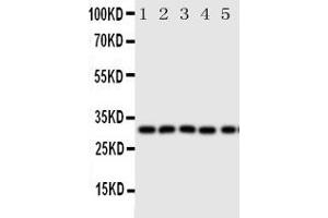 Anti-Aquaporin 9 antibody, Western blottingAll lanes: Anti Aquaporin 9  at 0.