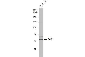 PAK1 antibody  (Center)