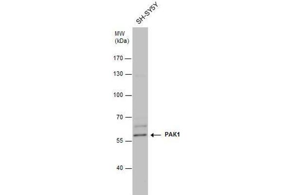 PAK1 antibody  (Center)