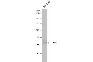 WB Image PAK1 antibody detects PAK1 protein by western blot analysis. (PAK1 antibody  (Center))