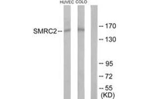 Western blot analysis of extracts from HuvEc/COLO205 cells, using SMRC2 Antibody. (SMARCC2 antibody  (AA 361-410))