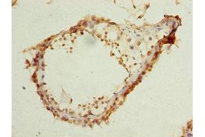 Immunohistochemistry (IHC) image for anti-ELAV (Embryonic Lethal, Abnormal Vision, Drosophila)-Like 4 (Hu Antigen D) (ELAVL4) (AA 1-150) antibody (ABIN7151487)