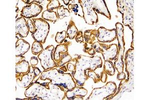 IHC analysis of TANK using anti-TANK antibody (ABIN6719508). (TANK antibody)
