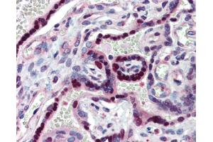 Immunohistochemistry (IHC) image for anti-Nuclear Receptor Subfamily 2, Group E, Member 1 (NR2E1) (N-Term) antibody (ABIN2779454)