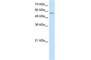 Western Blot showing PDCD4 antibody used at a concentration of 1-2 ug/ml to detect its target protein. (PDCD4 antibody  (N-Term))