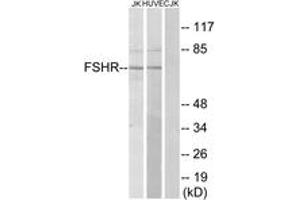 Western blot analysis of extracts from Jurkat/HuvEc cells, using FSHR Antibody. (FSHR antibody  (AA 211-260))