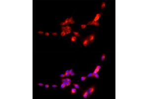 Immunofluorescence analysis of SH-SY5Y cells using SLC17 Rabbit pAb (ABIN6127303, ABIN6147863, ABIN6147864 and ABIN6216671) at dilution of 1:250 (40x lens). (SLC17A7 antibody  (AA 461-560))