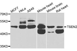 Western blot analysis of extracts of various cell lines, using TSEN2 antibody. (TSEN2 antibody)