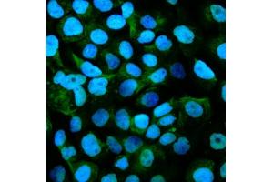 IF analysis of Gpnmb using anti-Gpnmb antibody (ABIN7600217). (Osteoactivin antibody  (AA 164-564))