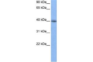 WB Suggested Anti-RBM9 Antibody Titration:  0.