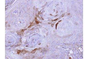Immunohistochemistry (IHC) image for anti-Activation-Induced Cytidine Deaminase (AICDA) (N-Term) antibody (ABIN2855890)