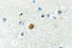 Image no. 1 for anti-Interferon Regulatory Factor 3 (IRF3) antibody (ABIN317879) (IRF3 antibody)