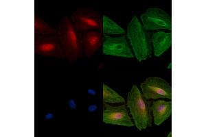 ABIN6257054 and ABIN6274619 staining  cells by IF/ICC. (CDK5RAP3 antibody  (Internal Region))