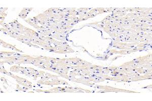 Detection of SLC in Rat Cardiac Muscle Tissue using Polyclonal Antibody to Secondary Lymphoid Tissue Chemokine (SLC) (CCL21 antibody  (AA 5-132))