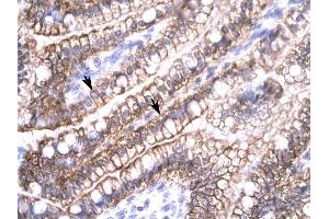 Claudin 8 antibody was used for immunohistochemistry at a concentration of 4-8 ug/ml to stain Epithelial cells of intestinal villus (arrows) in Human Intestine. (CLDN8 antibody  (C-Term))