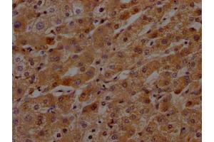 IHC image of ABIN7127592 diluted at 1:100 and staining in paraffin-embedded human liver tissue performed on a Leica BondTM system. (Recombinant KLKB1 antibody)