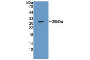 Figure. (Phospholipase C gamma 2 antibody  (AA 930-1152))