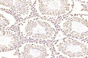 Immunohistochemistry analysis of paraffin-embedded rat testis using,RanBP16 (ABIN7073901) at dilution of 1: 2000 (Exportin 7 antibody)