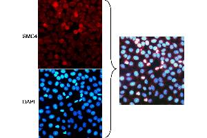 anti-Structural Maintenance of Chromosomes 4 (SMC4) (AA 600-650) antibody