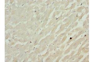 Immunohistochemistry of paraffin-embedded human heart tissue using ABIN7148048 at dilution of 1:100 (Cofilin 2 antibody  (AA 1-166))
