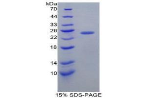 SDS-PAGE (SDS) image for Fibroblast Growth Factor Receptor Substrate 2 (FRS2) (AA 268-453) protein (His tag) (ABIN2124827) (FRS2 Protein (AA 268-453) (His tag))