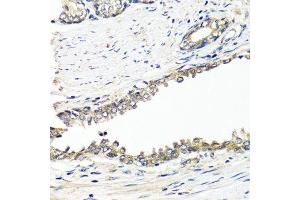 Immunohistochemistry of paraffin-embedded human prostate using BRCA1 antibody. (BRCA1 antibody  (AA 120-220))