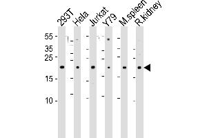 Western blot analysis of lysates from 293T, Hela, Jurkat, Y79 cell line , mouse spleen and rat kidney tissue lysate(from left to right), using DHFR Antibody (N-term) (ABIN6242878 and ABIN6577408). (Dihydrofolate Reductase antibody  (N-Term))