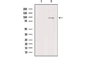 Western blot analysis of extracts from HepG2, using PLA2G4F Antibody. (PLA2G4F antibody  (C-Term))