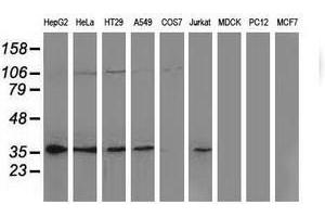 Image no. 2 for anti-Nonhomologous End-Joining Factor 1 (NHEJ1) antibody (ABIN1499732)