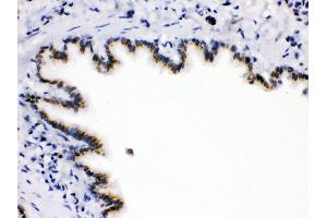 Anti-ARSA Picoband antibody,IHC(P) IHC(P): Rat Lung Tissue (Arylsulfatase A antibody  (C-Term))