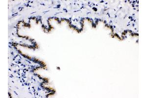 Anti-ARSA Picoband antibody,IHC(P) IHC(P): Rat Lung Tissue