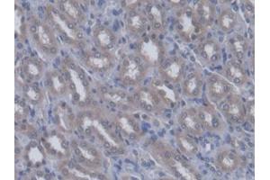 DAB staining on IHC-P; Samples: Rat Kidney Tissue (QARS antibody  (AA 2-206))