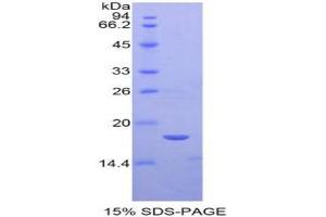 SDS-PAGE (SDS) image for Sema Domain, Immunoglobulin Domain (Ig), Short Basic Domain, Secreted, (Semaphorin) 3A (SEMA3A) protein (ABIN3011605)