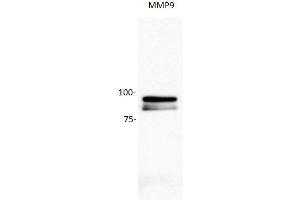 Image kindly submitted by Hailing Yang. (MMP 9 antibody  (AA 611-707))