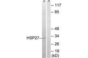 Western blot analysis of extracts from Jurkat cells, treated with Ca2+, using HSP27 (Ab-78) Antibody. (HSP27 antibody  (AA 45-94))