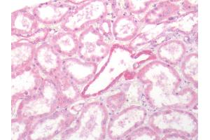 Human Kidney: Formalin-Fixed, Paraffin-Embedded (FFPE) (SSTR2 antibody  (Extracellular Domain))