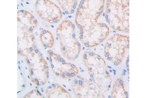 Figure. (Multimerin 1 antibody  (AA 807-1053))