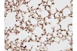 IHC-P Image Immunohistochemical analysis of paraffin-embedded human lung, using BAF57, antibody at 1:100 dilution. (SMARCE1 antibody  (C-Term))