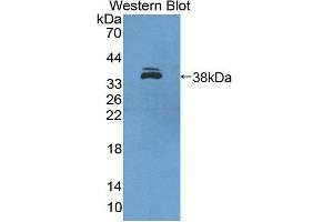 Western Blotting (WB) image for anti-Interferon Regulatory Factor 6 (IRF6) (AA 150-445) antibody (ABIN1859476) (IRF6 antibody  (AA 150-445))