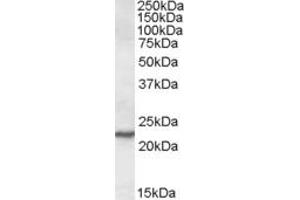 SAR1A antibody  (Internal Region)