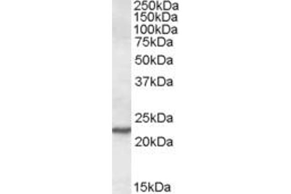 SAR1A antibody  (Internal Region)