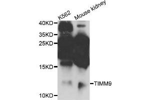 Western blot analysis of extracts of K562 and mouse kidney cells, using TIMM9 antibody.