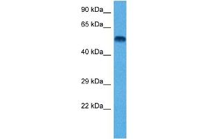 Host:  Rat  Target Name:  TUBB2A  Sample Tissue:  Rat Brain  Antibody Dilution:  1ug/ml (TUBB2A antibody  (N-Term))