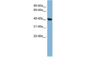WB Suggested Anti-PRKX Antibody Titration: 0. (PRKX antibody  (N-Term))