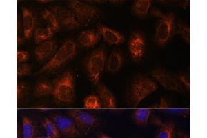 Immunofluorescence (IF) image for anti-Carbamoyl-Phosphate Synthetase 2, Aspartate Transcarbamylase, and Dihydroorotase (CAD) antibody (ABIN7264367)