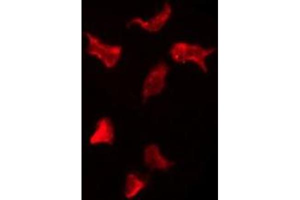 OR13H1 antibody  (C-Term)