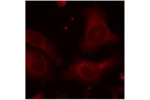 Image no. 3 for anti-Nuclear Factor of kappa Light Polypeptide Gene Enhancer in B-Cells 1 (NFKB1) (pSer927) antibody (ABIN319253)