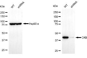 anti-Creatine Kinase, Brain (CKB) antibody